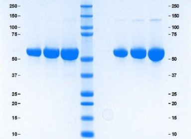 Athens-α1抗胰蛋白酶，促销中，助力科研加速跑