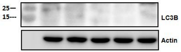 教你如何做出理想的LC3条带