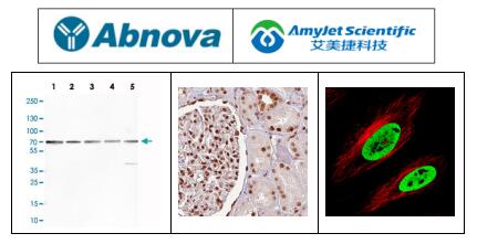 说明书丨Abnova艾美捷FUS 单克隆抗体,克隆 CL0190 说明书丨Abnova艾美捷FUS 单克隆抗体,克隆 CL0190