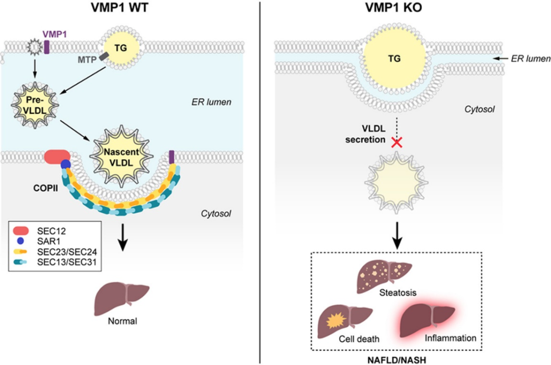 非酒精性脂肪性肝病患者脂肪变性的确切机制