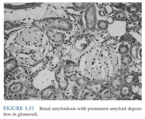 小鼠代谢和营养疾病知多少