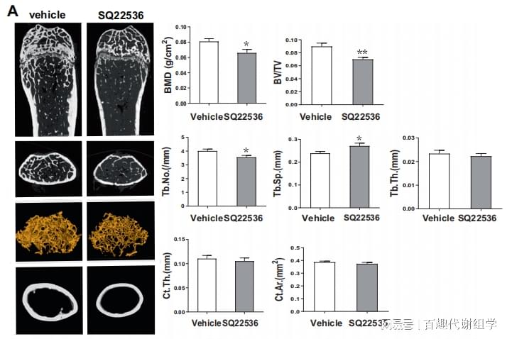 图9. 腺苷酸环化酶抑制阻断Ddr2Adipo骨表型