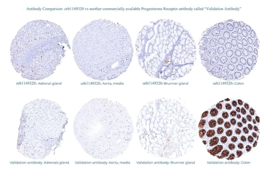 免疫组化专用高质量单抗：已经过大规模组织验证！