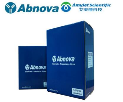 艾美捷Abnova PSMA磁珠解决方案 艾美捷Abnova PSMA磁珠解决方案