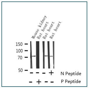 艾美捷磷酸化-Tau（Thr 231）抗体解决方案