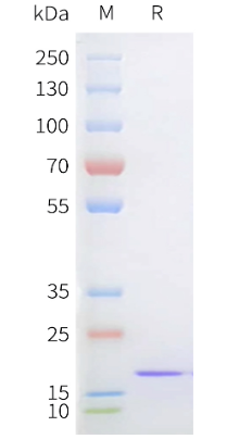DIMA BIOTECH Sortase A 5M蛋白,His标签-促销，尝鲜好机会