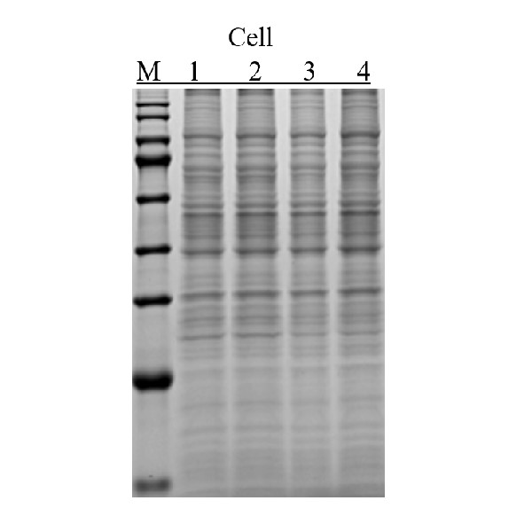 Ultra总蛋白提取试剂盒(蛋白组实验、质谱适用)-实验图片 Ultra总蛋白提取试剂盒(蛋白组实验、质谱适用)-实验图片