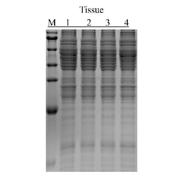 Ultra总蛋白提取试剂盒(蛋白相互作用适用(Pull-down、co-IP等))-实验图片 Ultra总蛋白提取试剂盒(蛋白相互作用适用(Pull-down、co-IP等))-实验图片