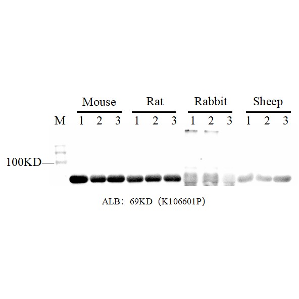 Ultra全血蛋白提取试剂盒-实验图片 Ultra全血蛋白提取试剂盒-实验图片