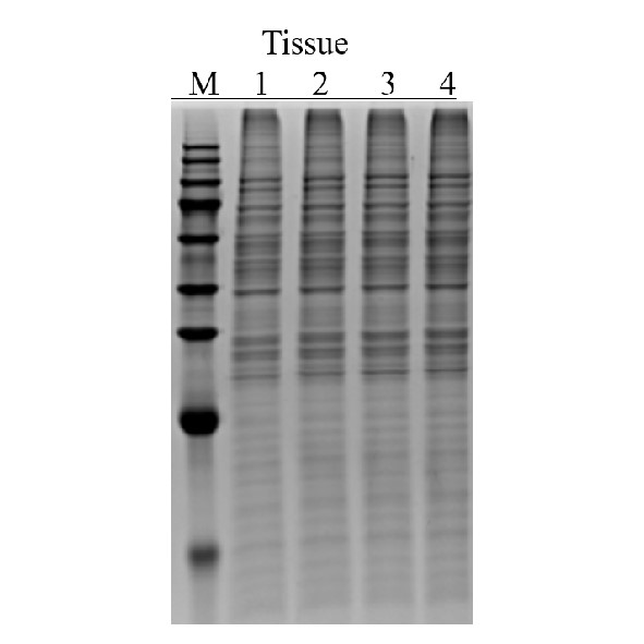 Ultra总蛋白提取试剂盒(蛋白组实验、质谱适用)-实验图片 Ultra总蛋白提取试剂盒(蛋白组实验、质谱适用)-实验图片