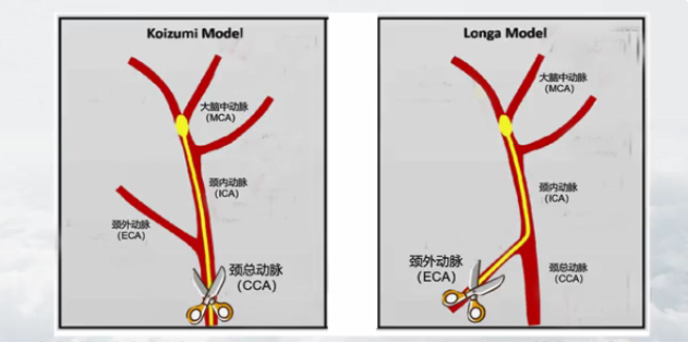 重磅推介丨脑卒中课题研究必看！缺血性脑卒中疾病研究整体解决方案