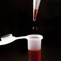 纤溶酶（Lysozyme）