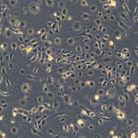 浙江美森-SV40T转化人脐静脉内皮细胞PUMC-HUVEC-T1现货