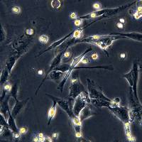 浙江美森-人骨骼肌永生化细胞IHSMC现货