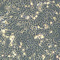 浙江美森-人永生化前列腺上皮细胞RWPE-2现货