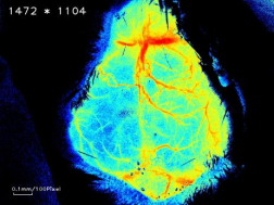 重磅推介丨脑卒中课题研究必看！缺血性脑卒中疾病研究整体解决方案