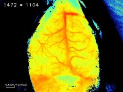 重磅推介丨脑卒中课题研究必看！缺血性脑卒中疾病研究整体解决方案