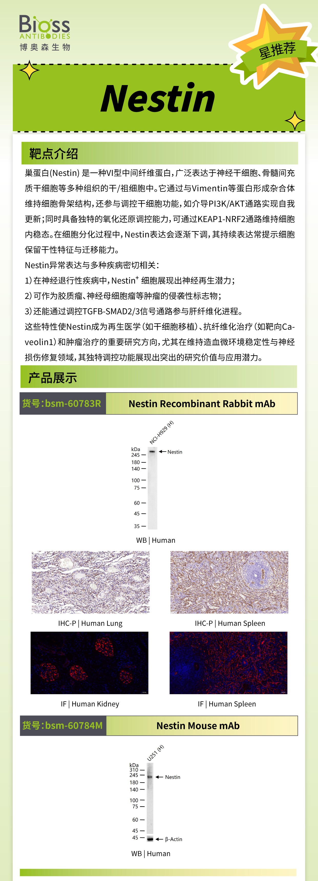 Bioss 星推荐 | Nestin 抗体