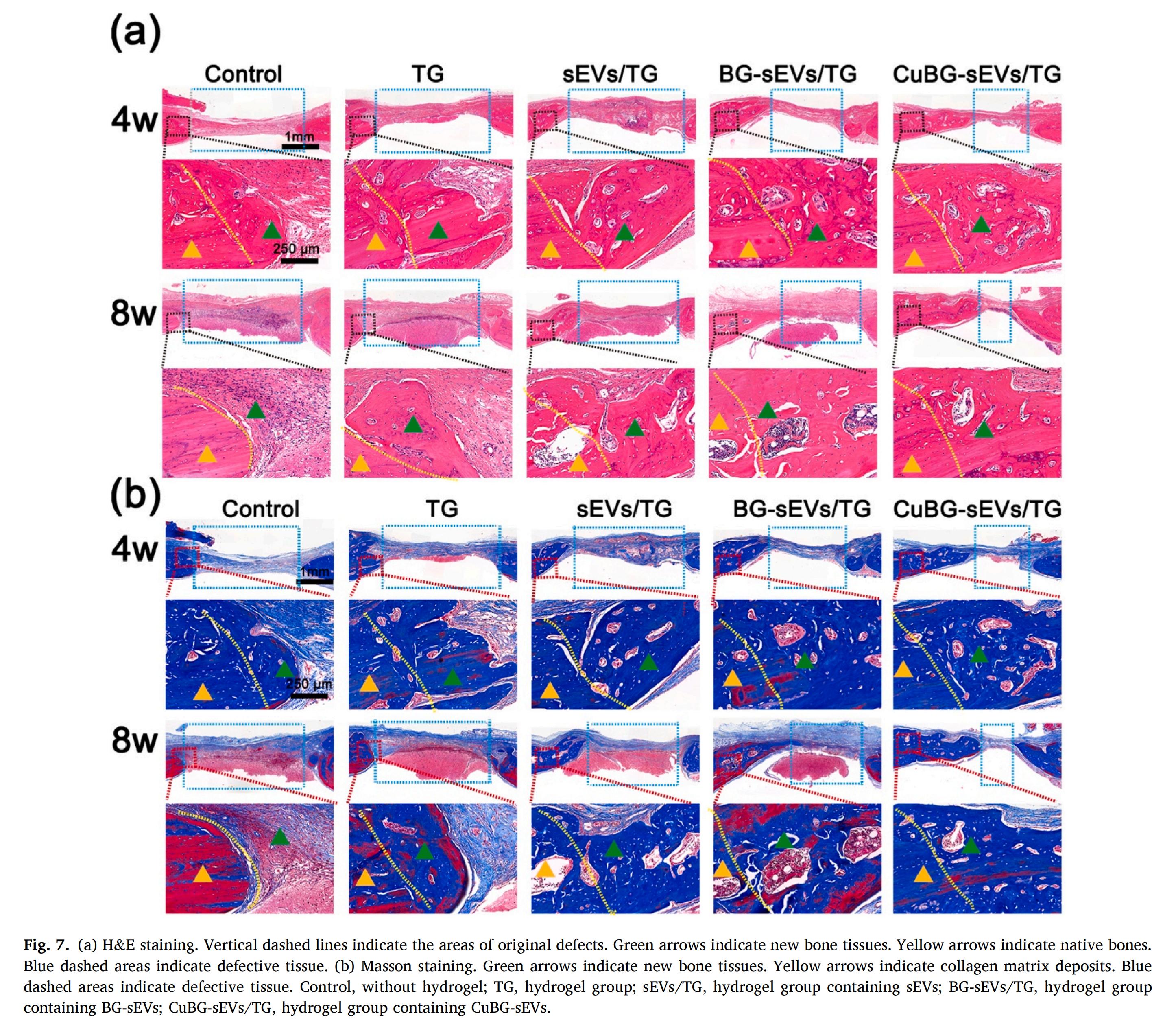 科研加油站 | 纳米振动激发器：HIF-1信号通路介导的细胞外囊泡作为促进骨再生的生物活性玻璃替代物