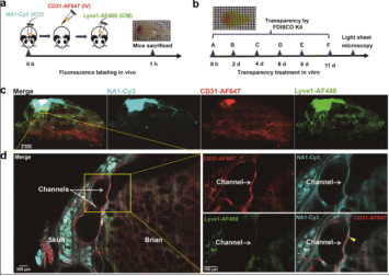 重磅推介丨脑卒中课题研究必看！缺血性脑卒中疾病研究整体解决方案