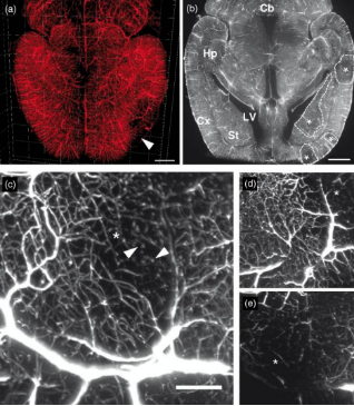 重磅推介丨脑卒中课题研究必看！缺血性脑卒中疾病研究整体解决方案