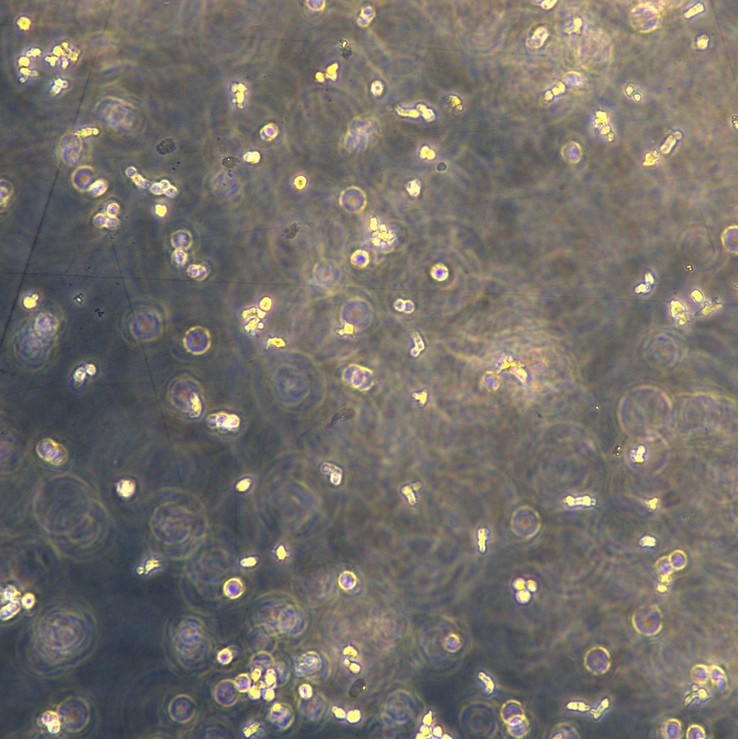 浙江美森-ALK 阳性间变性大细胞淋巴瘤 SU-DHL-1