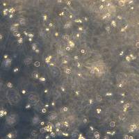 浙江美森-ALK 阳性间变性大细胞淋巴瘤 SU-DHL-1