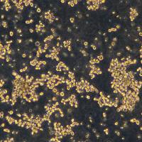 浙江美森-人乳腺上皮细胞DU4475现货