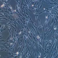 人主动脉平滑肌细胞-永生化