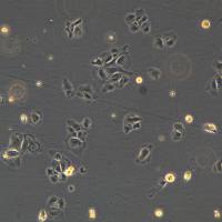 浙江美森-人肝癌细胞Hep3B现货