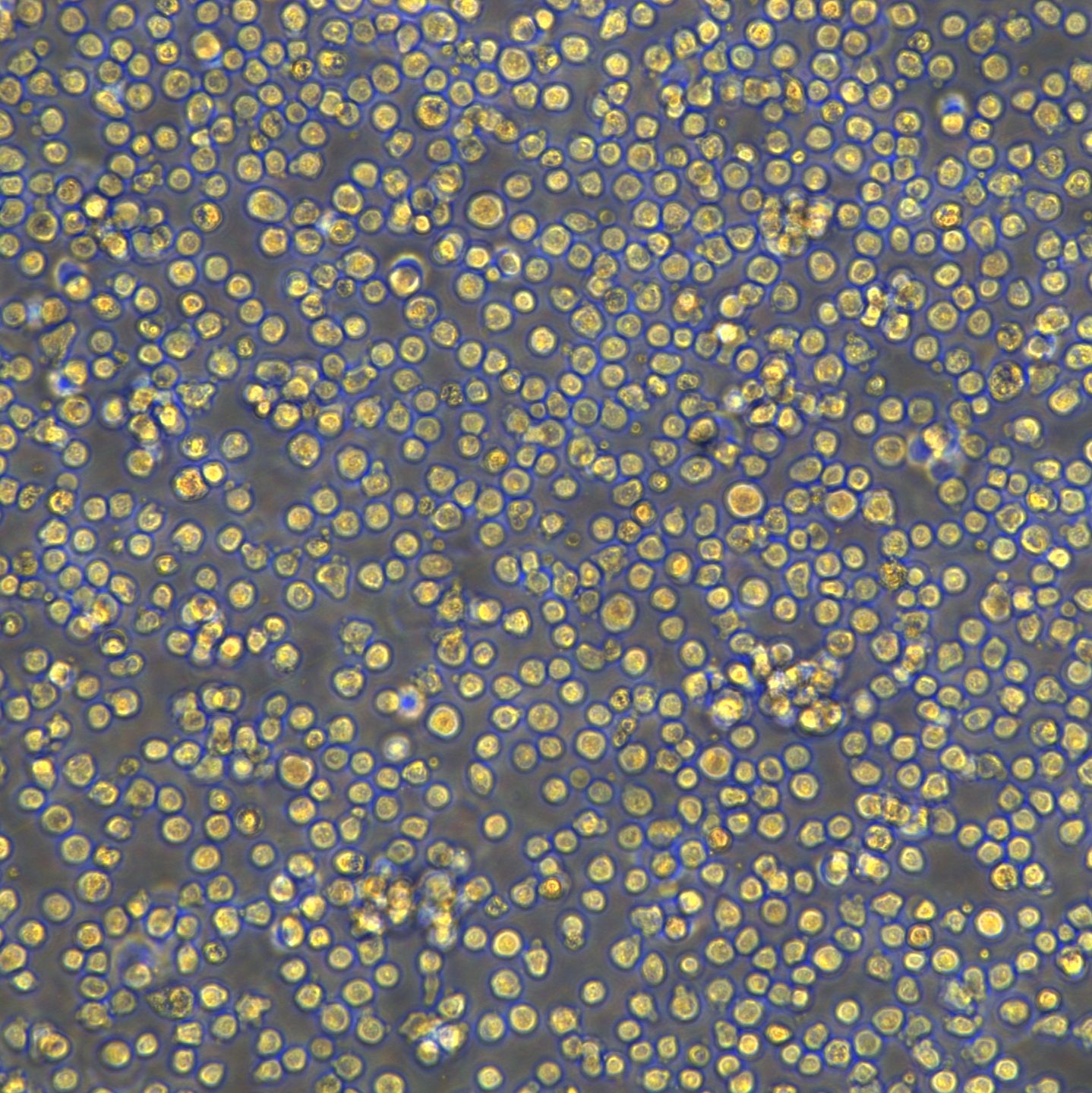 人淋巴母细胞伯基特淋巴瘤细胞Raji(Luc1)现货