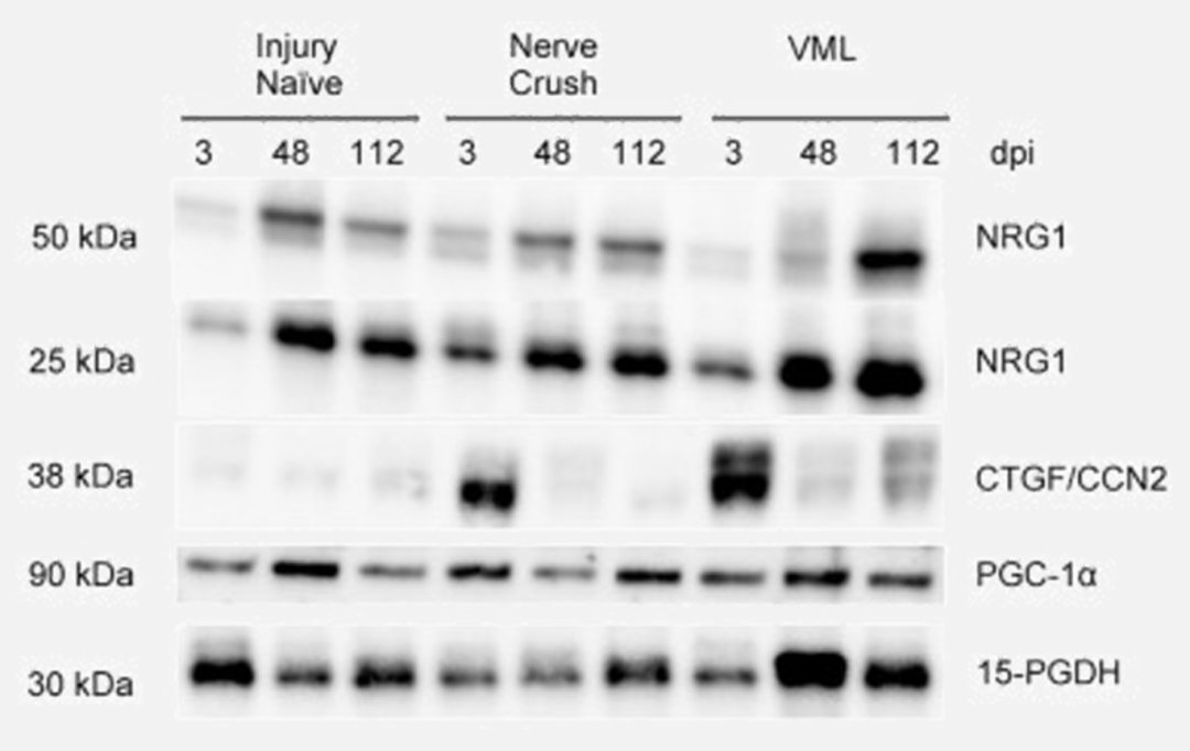 神经肌肉接头的重塑与再生