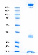 chylomicrons-gel-CHY2023-01-gel_website.jpg