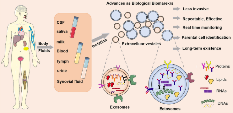 应用“泌”籍 | 特殊体液外囊泡超速离心纯化案例