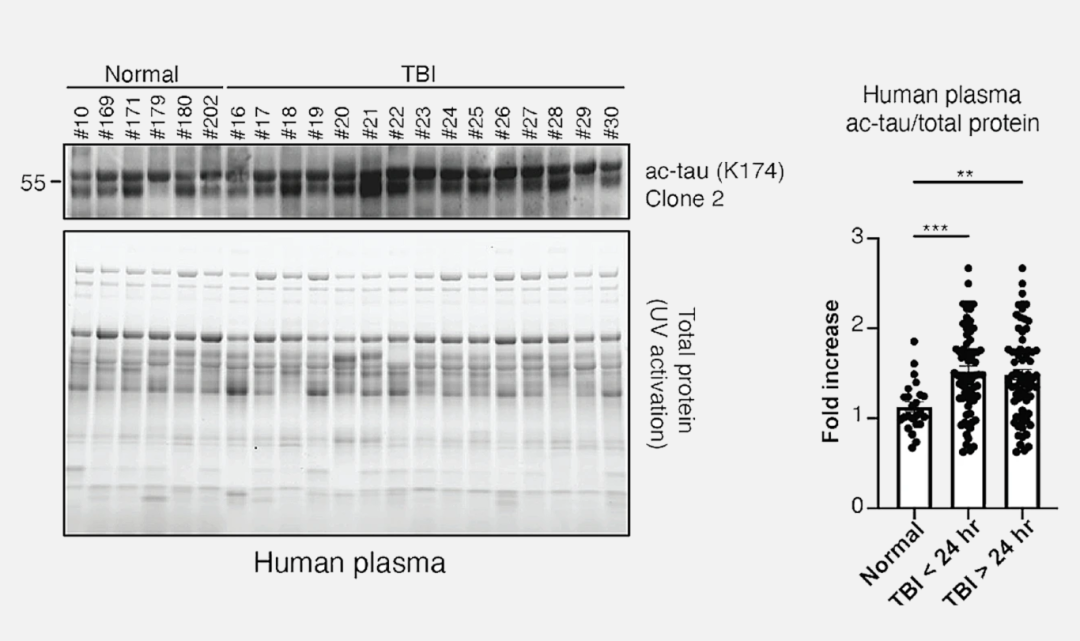 神经研究与Stain-Free技术:神经退行性疾病的免疫疗法