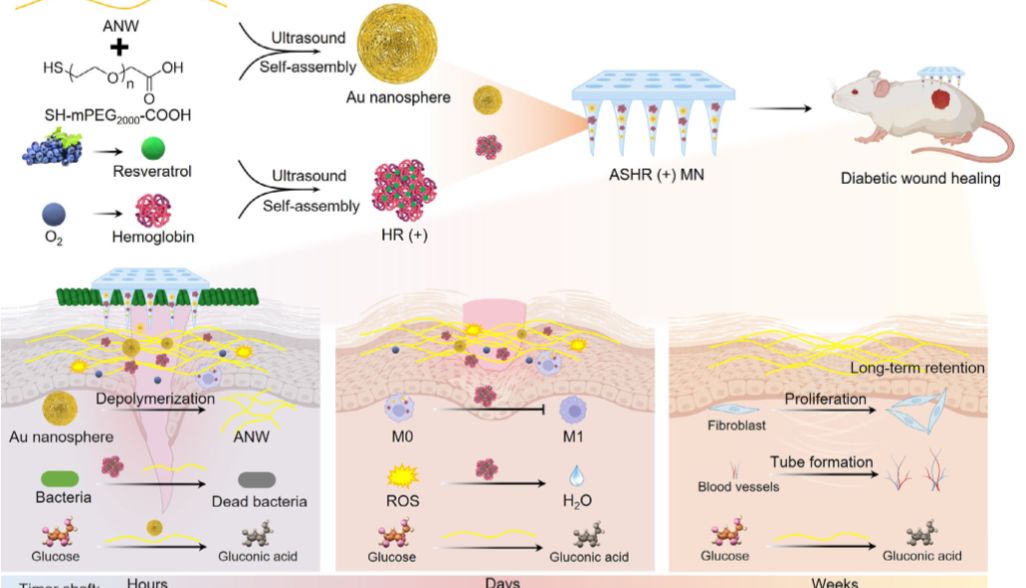 【IF 27.4】突破糖尿病创面愈合难题：Absin基质胶助力新型纳米给药系统研发