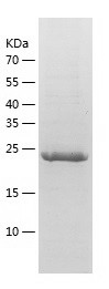 Recombinant Human THYN1/人源THYN