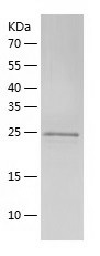 Recombinant Human UBTD2/人源UBTD