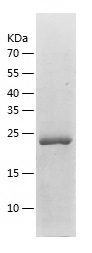 Recombinant Human ZNF22/人源ZNF2