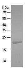 Recombinant Human PDCL3/人源PDCL
