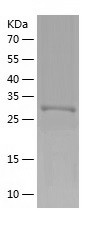 Recombinant Human LRATD1/人源LRA
