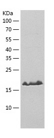 Recombinant Human DUSP3/人源DUSP