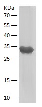 Recombinant Human κ-Casein/人源κ