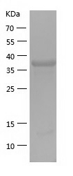 Recombinant Human RAB3IL1/人源RA