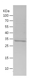 Recombinant Human UBA52/人源UBA5