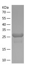 Recombinant Human ZNF43/人源ZNF4