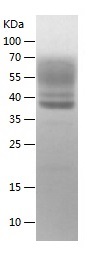 Recombinant Human IL-13/人源IL-1