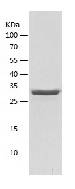 Recombinant Human UBXN2B/人源UBX