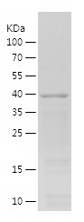 Recombinant Human CCNA2/人源CCNA