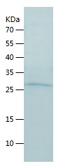 Recombinant Human PSMA2/人源PSMA